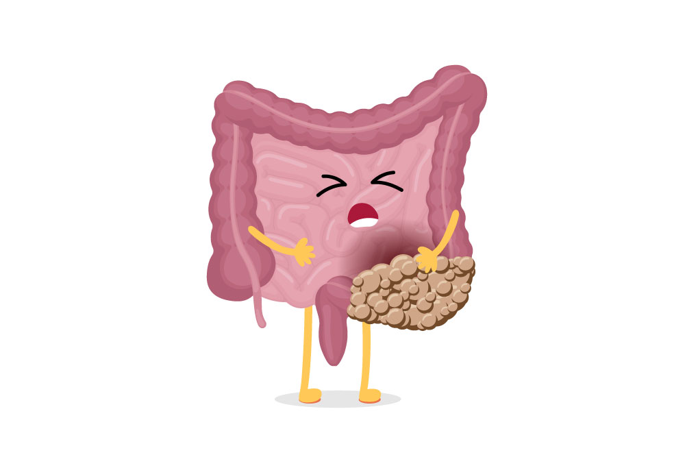 Prevention and Control of Metabolic Syndrome 