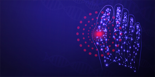 Be Aware of Gout Attacks